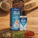 Від мозолів, натоптишів, бородавок рідина — фото 6