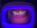 I-Cute skener zubného povlaku, zdravé čisté zuby Značka inna