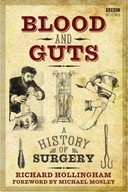 Blood and Guts: A History of Surgery Hollingham