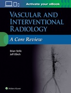 Vascular and Interventional Radiology: A Core