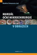 Manuál oční mikrochirurgie... kol.;Markéta Zema...