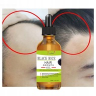 Liečba pokožky hlavy pre rastové sérum na vlasy