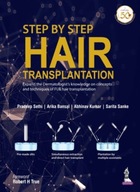 Step by Step Hair Transplantation Sethi Pradeep