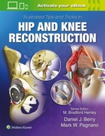 Illustrated Tips and Tricks in Hip and Knee