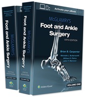 McGlamry s Foot and Ankle Surgery Praca zbiorowa