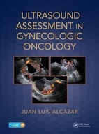 ULTRASOUND ASSESSMENT IN GYNECOLOGIC ONCOLOGY - Juan Luis Alcazar [KSIĄŻKA]