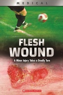 Flesh Wound (XBooks): A Minor Injury Takes a