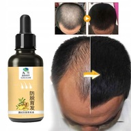 Hla-Produkty Stimulujúce rast vlasov Zázvor Rýchlo