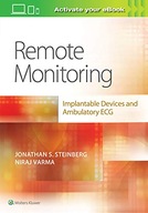 Remote Monitoring: implantable Devices and