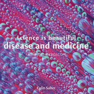Science is Beautiful: Disease and Medicine: Under