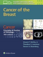 Cancer of the Breast: From Cancer: