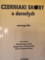 red. Włodzimierz Ruka CZERNIAKI SKÓRY U DOROSŁYCH