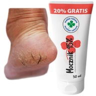 Exfoliačný krém zrohovatená močovina 45% HRUBÁ ŽLTÁ KOŽA NA PIATICH