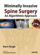 Minimally Invasive Spine Surgery: An Algorithmic