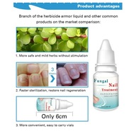 Účinná 10ml antimykotická kúra na nechty