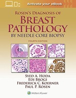 Rosen s Diagnosis of Breast Pathology by Needle