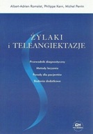 Żylaki i teleangiektazje