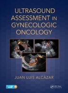 Ultrasound Assessment in Gynecologic Oncology JUAN LUIS ALCAZAR