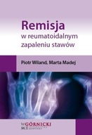 Remisja w reumatoidalnym zapaleniu stawów