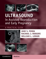 Ultrasound in Assisted Reproduction and Early