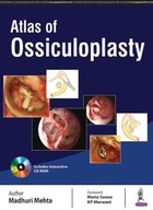 Atlas of Ossiculoplasty Mehta Madhuri