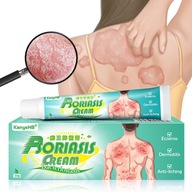 Psoriáza krém svrbenie úľava ekzém zápal