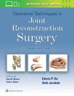 Operative Techniques in Joint Reconstruction