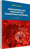 Okołooperacyjna profilaktyka zakrzepowo-zatorowa -