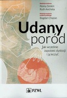 UDANY PORÓD