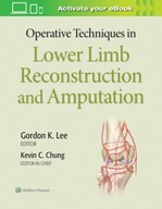 Operative Techniques in Lower Limb