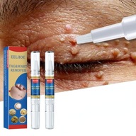 Tag&wart Remove Skin Mole Removal Pen To You