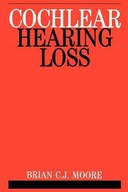 Cochlear Hearing Loss Moore Brian C. J.