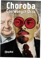 Choroba czerwonych oczu - Stanisław Michalkiewicz