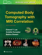 Computed Body Tomography with MRI Correlation Lee