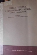 Przeszczepianie i konserwacja tkanek w Klinice Czł