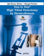 Step by Step: High Tibial Osteotomy by