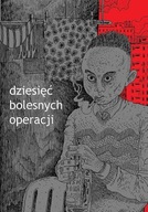 Dziesięć bolesnych operacji