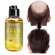 Zázvorový šampón pre vlasy Rýchly opätovný rast vlasov