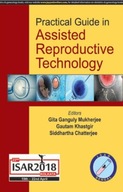 Practical Guide in Assisted Reproductive