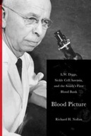 Blood Picture: L.W. Diggs, Sickle Cell Anemia,