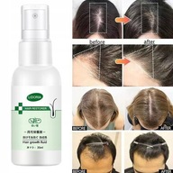 Sérum na rast vlasov Spray Tonikum na vlasy Pre