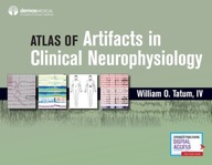 Artifacts in Clinical Neurophysiology Praca