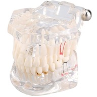 Verk 01964_B Model implantów stomatologicznyc