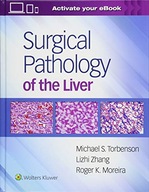 Surgical Pathology of the Liver Torbenson Michael
