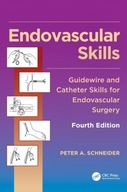 Endovascular Skills: Guidewire and Catheter