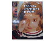 Choroby alergiczne u dzieci - John O. warner