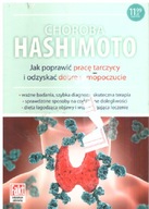 Choroba Hashimoto