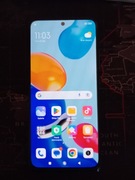 Xiaomi Redmi 11 Note