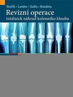 Revizní operace totálních náhrad kolenního kloubu Paweł Wavřík