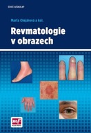 Revmatologie v obrazech Marta Olejárová